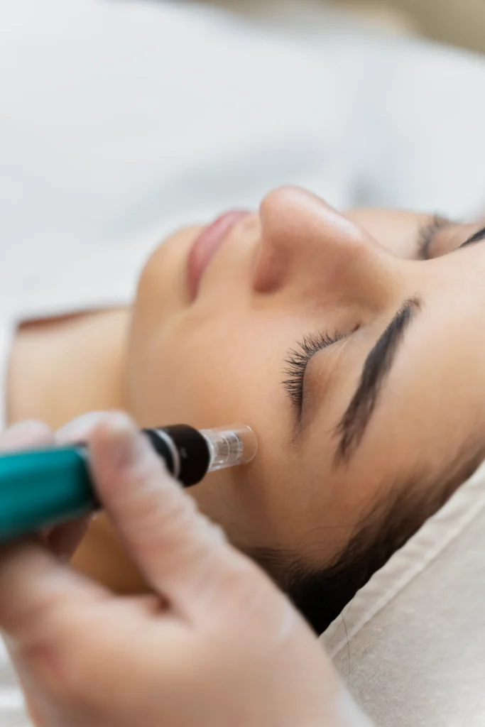 Microneedling Medical